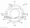 Fig. 01 - Methods for rotationally stabilizing contact lenses