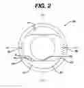 Fig. 03 - Methods for rotationally stabilizing contact lenses