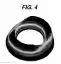 Fig. 05 - Methods for rotationally stabilizing contact lenses