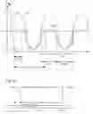Fig. 10 - Lithographic apparatus and device manufacturing method using interferometric and maskless exposure units