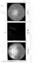 Fig. 06 - Lens inspection system using phase contrast imaging