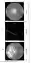 Fig. 07 - Lens inspection system using phase contrast imaging