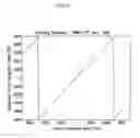 Fig. 11 - System and method for timing acquisition and carrier frequency offset estimation in wireless communication based on OFDM