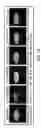 Fig. 07 - Method and system of CT data correction
