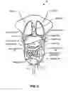 Fig. 05 - Respiration phantom for quality assurance