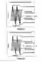 Fig. 09 - Apparatus and method for providing an orthographic projection from helical scan data