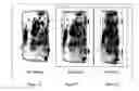 Fig. 11 - Apparatus and method for providing an orthographic projection from helical scan data