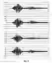 Fig. 04 - Method and apparatus for masking acoustic keyboard emanations