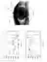 Fig. 09 - Standoff iris recognition system