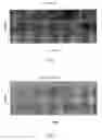 Fig. 02 - Method for determining a three-dimensional structure from a two-dimensional image, in particular a bone structure
