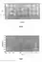 Fig. 05 - Method for determining a three-dimensional structure from a two-dimensional image, in particular a bone structure