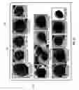 Fig. 23 - Automated detection of objects in a biological sample