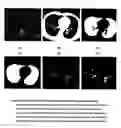 Fig. 04 - Method and apparatus for automated detection of target structures from medical images using a 3D morphological matching algorithm