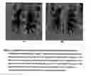 Fig. 05 - Method and apparatus for automated detection of target structures from medical images using a 3D morphological matching algorithm