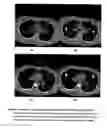 Fig. 06 - Method and apparatus for automated detection of target structures from medical images using a 3D morphological matching algorithm