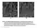 Fig. 07 - Method and apparatus for automated detection of target structures from medical images using a 3D morphological matching algorithm