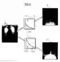 Fig. 06 - Method and unit for refining digital x-ray images