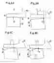 Fig. 04 - Bearing surface and bearing element