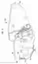 Fig. 07 - Methods for printer cartridge modification