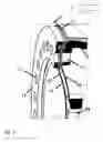 Fig. 06 - Cleaning device