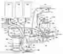 Fig. 01 - Active air removal system operating modes of an extracorporeal blood circuit