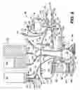 Fig. 08 - Active air removal system operating modes of an extracorporeal blood circuit
