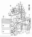 Fig. 09 - Active air removal system operating modes of an extracorporeal blood circuit