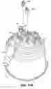 Fig. 14 - Active air removal system operating modes of an extracorporeal blood circuit