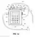 Fig. 15 - Active air removal system operating modes of an extracorporeal blood circuit