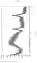 Fig. 03 - Layered porous titanium oxide, process for producing the same, and catalyst comprising the same