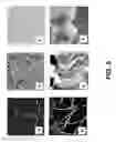 Fig. 06 - Methods for imaging soluble A-beta