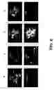 Fig. 07 - Methods for imaging soluble A-beta