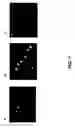 Fig. 08 - Methods for imaging soluble A-beta