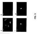 Fig. 10 - Methods for imaging soluble A-beta