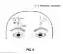 Fig. 04 - METHOD FOR DETERMINING BOTULINUM POTENCY