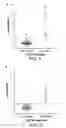 Fig. 02 - Methods of depleting antibodies directed towards major histocompatibility complex