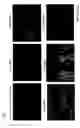 Fig. 12 - Anti-A33 antibody