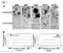 Fig. 08 - Method for Diagnosing, Prognosing and Treating Glioma