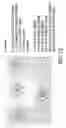 Fig. 13 - Polysaccharide-staphylococcal surface adhesin carrier protein conjugates for immunization against nosocomial infections