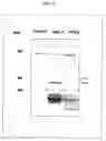 Fig. 04 - Cell surface expression vector of parvovirus antigen and microorganisms transformed thereof