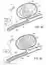 Fig. 06 - Forming coils