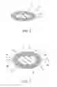 Fig. 08 - Drug-eluting biodegradable stent