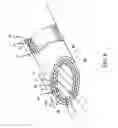 Fig. 09 - Drug-eluting biodegradable stent