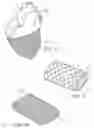 Fig. 11 - DRUG ELUTING IMPLANT