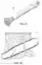 Fig. 16 - DRUG ELUTING IMPLANT