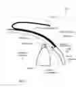 Fig. 02 - Glaucoma Implant Device