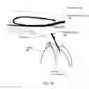 Fig. 08 - Glaucoma Implant Device