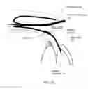 Fig. 09 - Glaucoma Implant Device