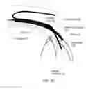 Fig. 10 - Glaucoma Implant Device