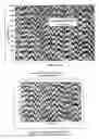 Fig. 06 - Process for controlling the density, conformation and composition of the hydrophilic layer of a polyurethane composite